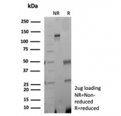 SDS-PAGE analysis of purified, BSA-free recombinant CKBB antibody (clone rCKBB/8842) as confirmation of integrity and purity.