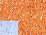 Creatine Kinase B Antibody Human Brain IHC. Immunohistochemistry analysis of FFPE human brain tissue using Creatine Kinase B antibody. The recombinant rabbit monoclonal antibody clone CKBB/8608R demonstrates strong, diffuse cytoplasmic staining in neurons, highlighting Creatine kinase B / CKB as a neuronal cytoplasmic marker. Neuronal cell bodies and processes show robust signal, while surrounding non-neuronal elements display comparatively lower staining, supporting its use in identifying metabolically active neuronal populations. A PBS-only control confirms minimal non-specific staining. HIER: boil tissue sections in 10 mM Tris with 1 mM EDTA, pH 9, for 20 min followed by cooling prior to staining.