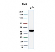 Creatine Phosphokinase BB Antibody Y79 Cell WB. Western blot testing of human Y79 cell lysate with Creatine phosphokinase BB antibody (clone CKBB/8609R). Predicted molecular weight ~43 kDa.