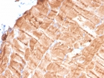 TPM1 Antibody Human Skeletal Muscle IHC. Immunohistochemical staining of FFPE human skeletal muscle tissue using TPM1 Antibody / Muscle Contractile Protein Antibody (clone TPM1/4510) demonstrates strong cytoplasmic HRP-DAB brown staining throughout skeletal muscle fibers. The staining pattern is consistent with expression of TPM1 (Tropomyosin Alpha-1 Chain), an actin-binding protein that forms a critical component of the thin filament apparatus and regulates actin-myosin interactions during muscle contraction. Robust immunoreactivity within myofibers highlights the essential role of TPM1 in sarcomere organization, contractile function, and maintenance of skeletal muscle structure. HIER: boil tissue sections in pH 9, 10mM Tris with 1mM EDTA for 20 min and allow to cool before testing.