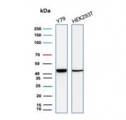 Western blot testing of human Y79 and HEK293 cell lysate with Creatine phosphokinase BB antibody (clone CKBB/8840R). Predicted molecular weight ~43 kDa.