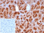 IHC analysis of ZAP75 Antibody / Glycoprotein 2 in human pancreas. ZAP75 antibody (clone GP2/8229R) was used for immunohistochemistry on FFPE human pancreas tissue. Strong HRP-DAB brown cytoplasmic and apical staining is observed in pancreatic acinar cells, consistent with the known localization of Glycoprotein 2 (GP2) to pancreatic zymogen granule membranes in exocrine pancreas. The staining highlights acinar epithelial cells surrounding pancreatic ducts, while surrounding stromal regions show minimal signal. Inset: PBS used in place of primary antibody as a secondary antibody negative control. HIER: boil tissue sections in pH 9 10mM Tris with 1mM EDTA for 20 min and allow to cool before testing.