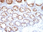 Estrogen Inducible Protein pS2 Antibody C-Terminus. Immunohistochemistry analysis of Trefoil factor 1 (TFF1) in formalin-fixed, paraffin-embedded human colon tissue using Estrogen Inducible Protein pS2 Antibody C-Terminus clone TFF1/8817R. Glandular epithelial cells display HRP-DAB brown cytoplasmic staining consistent with expression of the estrogen regulated secretory peptide TFF1 (pS2). Hematoxylin counterstain highlights nuclei (blue). Antigen retrieval was performed by boiling tissue sections in pH 9 10mM Tris with 1mM EDTA for 20 min followed by cooling prior to immunohistochemistry staining.