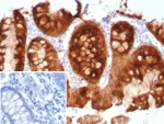 Estrogen Inducible Protein pS2 Antibody C-Terminus. Immunohistochemistry analysis of Trefoil factor 1 (TFF1) in formalin-fixed, paraffin-embedded human colon tissue using Estrogen Inducible Protein pS2 Antibody C-Terminus clone TFF1/8817R. Glandular epithelial cells demonstrate HRP-DAB brown cytoplasmic staining consistent with expression of the estrogen regulated secretory peptide TFF1 (pS2). Hematoxylin counterstain highlights nuclei (blue). Antigen retrieval was performed by boiling tissue sections in pH 9 10mM Tris with 1mM EDTA for 20 min followed by cooling prior to immunohistochemistry staining. Inset: PBS was used in place of the primary antibody as a secondary antibody negative control.