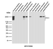 MYH11 Antibody Cross-Species Gastrointestinal WB. Western blot analysis of intestine and stomach tissue lysates from multiple species was performed using MYH11 antibody clone rMYH11/8066. Samples include human, mouse, rat, hamster, guinea pig, and rabbit intestine and stomach tissues. MYH11, also known as Smooth Muscle Myosin Heavy Chain, is a major component of the contractile apparatus and a highly specific marker of differentiated smooth muscle cells. Strong bands are detected at approximately 200 kDa in human, guinea pig, and rabbit intestine, consistent with the expected molecular weight of full length MYH11. Minor higher molecular weight species likely represent alternatively spliced isoforms or post-translationally modified forms. These results demonstrate the cross-species reactivity of recombinant MYH11 antibody and support its utility for studies of smooth muscle differentiation, gastrointestinal physiology, and comparative biology.