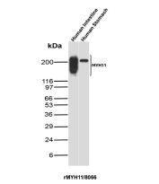 MYH11 Antibody Human Gastrointestinal Tissues WB. Western blot analysis of human intestine and human stomach tissue lysates was performed using MYH11 antibody clone rMYH11/8066. MYH11, also known as Smooth Muscle Myosin Heavy Chain, is a major contractile protein and a highly specific marker of differentiated smooth muscle cells. Prominent immunoreactive bands are detected at approximately 200 kDa in both tissues, corresponding to the expected molecular weight of full-length MYH11. The broader signal observed in intestine likely reflects the presence of multiple MYH11 isoforms and post-translationally modified species associated with visceral smooth muscle. These results support the utility of recombinant MYH11 antibody for studies of smooth muscle differentiation, gastrointestinal physiology, and contractile function.