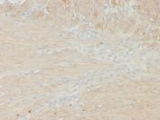 MYH11 Antibody Colon Smooth Muscle IHC. Immunohistochemical staining of FFPE human colon smooth muscle tissue demonstrates MYH11 expression using recombinant MYH11 antibody clone rMYH11/8066. MYH11, also known as Smooth Muscle Myosin Heavy Chain, is a principal component of the contractile apparatus and a highly specific marker of differentiated smooth muscle cells. Diffuse cytoplasmic staining is observed throughout bundles of smooth muscle fibers within the muscularis propria, consistent with the abundant expression of MYH11 in visceral smooth muscle responsible for intestinal motility. Heat induced epitope retrieval was performed by boiling tissue sections in pH 9 10 mM Tris with 1 mM EDTA for 20 minutes followed by cooling prior to staining. These results support the utility of MYH11 Antibody for studies of smooth muscle differentiation, gastrointestinal physiology, and contractile function.