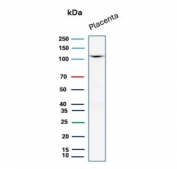 CDH1 Antibody for WB. Western blot analysis of Cadherin 1 / CDH1 expression in human placental tissue lysate using clone rCDH1/7352 antibody, showing a band consistent with the predicted molecular weight of E-cadherin. E-cadherin is synthesized as a precursor and undergoes glycosylation, resulting in an apparent molecular weight typically observed between approximately 80-120 kDa, with the precursor form near 135 kDa. The detected band aligns with mature glycosylated E-cadherin expressed in placental epithelial tissue.