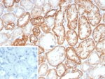 Ksp-Cadherin Antibody Kidney IHC. Immunohistochemical analysis of Cadherin-16 / CDH16, also known as Ksp-Cadherin, in formalin-fixed, paraffin-embedded human kidney tissue using Ksp-Cadherin antibody clone CDH16/8800R. Strong membranous staining is observed in renal tubular epithelial cells, outlining well-defined tubular structures consistent with kidney-specific expression of CDH16. The selective staining pattern supports a human kidney-enriched detection profile for this clone. Background staining is minimal. Inset: PBS used in place of primary antibody serves as a negative control for secondary antibody binding. Required HIER: boil tissue sections in pH 9 10mM Tris with 1mM EDTA for 20 min and allow to cool before testing.