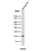 HP Antibody HP/3831 Detection in Human Liver WB. Western blot testing of human liver tissue lysate with HP Antibody clone HP/3831 shows a strong, discrete band at approximately 24 kDa. Haptoglobin is synthesized as an approximately 45 kDa precursor that undergoes proteolytic processing into alpha and beta chains; the observed band is consistent with the processed haptoglobin beta chain, whose apparent molecular weight can also be influenced by glycosylation.