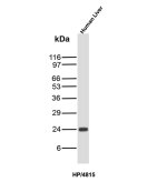 Haptoglobin Antibody HP/4815 Detection in Human Liver WB. Western blot analysis of human liver tissue lysate using Haptoglobin Antibody clone HP/4815. A strong, discrete band is detected at approximately 24 kDa. Haptoglobin is synthesized as an approximately 45 kDa precursor that undergoes proteolytic processing into alpha and beta chains; the observed ~24 kDa band is consistent with the processed haptoglobin beta chain, whose apparent molecular weight can be influenced by glycosylation.