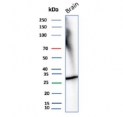 Western blot testing of human brain tissue lysate with recombinant CALB2 antibody. Predicted molecular weight ~29 kDa.