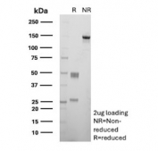 SDS-PAGE analysis of purified, BSA-free recombinant CALB2 antibody (clone rCALB2/7123) as confirmation of integrity and purity.
