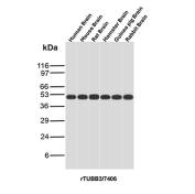 TUBB3 Antibody Cross-Species Brain WB. Western blot analysis of Beta III tubulin (TUBB3) expression across brain lysates from multiple species using TUBB3 antibody clone rTUBB3/7406. Lane 1: human brain lysate, Lane 2: mouse brain lysate, Lane 3: rat brain lysate, Lane 4: hamster brain lysate, Lane 5: guinea pig brain lysate, Lane 6: rabbit brain lysate. A band is detected at approximately 50-55 kDa in all samples, consistent with the predicted molecular weight of TUBB3. The uniform banding pattern across species supports the use of this clone for cross-species western blot validation.