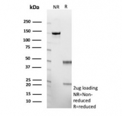 SDS-PAGE analysis of purified, BSA-free recombinant YWHAE antibody (clone rYWHAE/8860) as confirmation of integrity and purity.