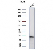 GCSF Antibody U-87 WB. Western blot analysis of Granulocyte colony stimulating factor / CSF3 in human U-87 cell lysate using mouse monoclonal GCSF antibody, clone CSF3/4594. A band is detected at approximately 22 kDa, consistent with the predicted molecular weight of G-CSF, supporting detection of this cytokine in glioblastoma-derived cells.