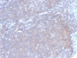 Granulocyte-Colony Stimulating Factor Antibody Lymph Node Immunohistochemistry. IHC analysis of FFPE human lymph node tissue with G-CSF antibody (clone CSF3/4597). HIER: boil tissue sections in pH 9 10mM Tris with 1mM EDTA for 20 min and allow to cool before testing.