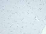 Negative control: IHC testing of FFPE human brain tissue using recombinant KRT14 antibody (clone rKRT14/7368) at 2ug/ml. HIER: boil tissue sections in pH 9 10mM Tris with 1mM EDTA for 20 min and allow to cool before testing.