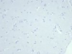 Negative control: IHC testing of FFPE human brain tissue using recombinant KRT14 antibody (clone rKRT14/7368) at 2ug/ml. HIER: boil tissue sections in pH 9 10mM Tris with 1mM EDTA for 20 min and allow to cool before testing.