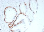 IHC staining of FFPE human prostate tissue with Cytokeratin 14 antibody (clone rKRT14/8692) at 2ug/ml. HIER: boil tissue sections in pH 9 10mM Tris with 1mM EDTA for 20 min and allow to cool before testing.