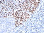 TOP2A Antibody / Cell Proliferation Marker Antibody (clone rTOP2A/8339). Immunohistochemistry analysis of FFPE human tonsil tissue demonstrates strong nuclear staining consistent with expression of the TOP2A proliferation marker in actively dividing lymphoid cells. Nuclear immunoreactivity is concentrated within germinal center lymphocytes, reflecting the high proliferative activity of these cells during immune responses. The Cell Proliferation Marker Antibody highlights proliferating lymphoid populations within germinal centers while surrounding mantle zone lymphocytes show minimal staining. Inset: PBS used in place of primary antibody (secondary antibody negative control). Antigen retrieval was performed by boiling tissue sections in pH 9 Tris-EDTA buffer prior to immunohistochemistry staining.