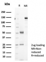 SDS-PAGE analysis of purified, BSA-free recombinant CK19/Cytokeratin 19 antibody (clone KRT19/8091R) as confirmation of integrity and purity.