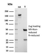 Cytokeratin 10 Antibody KRT10/7804R by SDS-PAGE. SDS-PAGE analysis of purified Cytokeratin 10 Antibody KRT10/7804R under non-reducing (NR) and reducing (R) conditions, with 2 ug of antibody loaded per lane. The non-reducing lane shows a prominent band migrating at approximately 150 kDa, consistent with intact IgG. Under reducing conditions, distinct bands are observed at approximately 50 kDa and 25 kDa, corresponding to the immunoglobulin heavy and light chains, respectively. The CK10 Rabbit Monoclonal Antibody demonstrates the expected electrophoretic profile of a purified rabbit IgG preparation.