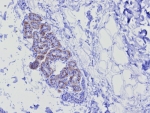 Keratin 17 Antibody Recombinant Rabbit MAb KRT17/8346R immunohistochemistry analysis of human skin tissue. Immunohistochemistry of FFPE human skin demonstrates cytoplasmic brown chromogenic staining in epithelial structures using the recombinant rabbit monoclonal Keratin 17 antibody KRT17/8346R. Staining highlights epithelial cells consistent with the known expression pattern of Cytokeratin 17 (CK17 / KRT17), an epithelial intermediate filament protein enriched in basal and appendage-associated epithelial compartments of skin. Heat-induced epitope retrieval was performed by boiling tissue sections in pH 9 10mM Tris with 1mM EDTA for 20 minutes followed by cooling prior to antibody incubation.