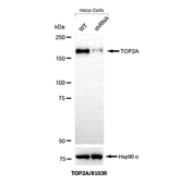 Topoisomerase II alpha Antibody Knockdown Validation WB. Western blot analysis of TOP2A expression in wild-type (WT) and TOP2A shRNA knockdown HeLa cells using Topoisomerase II alpha antibody clone TOP2A/8103R. Lane 1: WT lysate, Lane 2: shRNA knockdown lysate. The band at approximately 160-170 kDa is reduced in knockdown cells, supporting target-specific detection. Hsp90 alpha is shown as a loading control.