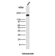 Topoisomerase II alpha Antibody A549 Cell WB. Western blot analysis of TOP2A expression in human A549 cell lysate using Topoisomerase II alpha antibody clone TOP2A/8103R. A band is detected at approximately 160-170 kDa, consistent with the predicted molecular weight of TOP2A.