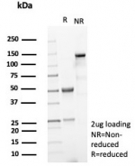 SDS-PAGE analysis of purified, BSA-free Cytokeratin 15 antibody (clone KRT15/8312R) as confirmation of integrity and purity.