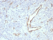 IHC staining of FFPE human uterus tissue with recombinant PECAM antibody (clone rPECAM1/8826). HIER: boil tissue sections in pH 9 10mM Tris with 1mM EDTA for 20 min and allow to cool before testing.