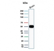 Western blot testing of human brain tissue with GFAP antibody. Predicted molecular weight ~50 kDa.