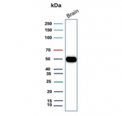 Western blot testing of human brain tissue with GFAP antibody. Predicted molecular weight ~50 kDa.