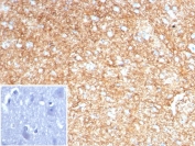 IHC staining of FFPE human brain tissue with GFAP antibody (clone GFAP/8616R). Inset: PBS used in place of primary Ab (secondary Ab negative control). HIER: boil tissue sections in pH 9 10mM Tris with 1mM EDTA for 20 min and allow to cool before testing.