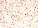 MPO Antibody Mouse Monoclonal rMPO/8694 / Myeloperoxidase Antibody. Immunohistochemistry analysis of MPO Antibody Mouse Monoclonal rMPO/8694 in FFPE human spleen tissue. Brown chromogenic staining identifies cytoplasmic Myeloperoxidase / MPO-positive myeloid cells distributed throughout the splenic tissue. Heat-induced epitope retrieval was performed by boiling tissue sections in pH 9 10mM Tris with 1mM EDTA for 20 minutes followed by cooling prior to staining.