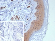 IHC analysis of NME2 / Nucleoside diphosphate kinase B antibody in human skin tissue. Formalin-fixed, paraffin-embedded human skin shows cytoplasmic HRP-DAB brown chromogenic staining predominantly within epidermal keratinocytes, with weaker staining in the dermal compartment. Clone NME2/6433 demonstrates specific signal following heat-induced epitope retrieval in pH 9 10mM Tris with 1mM EDTA for 20 min. The inset negative control using PBS instead of primary antibody shows no specific staining.