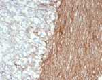 IHC staining of FFPE human brain tissue with GFAP antibody (clone GFAP/6886). HIER: boil tissue sections in pH 9 10mM Tris with 1mM EDTA for 20 min and allow to cool before testing.