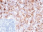 MPO Antibody Recombinant Rabbit MAb MPO/8290R / Myeloperoxidase Antibody. Immunohistochemistry analysis of MPO Antibody Recombinant Rabbit MAb MPO/8290R in FFPE human spleen tissue. Cytoplasmic brown staining identifies Myeloperoxidase / MPO-positive myeloid cells within splenic tissue, while surrounding cells remain negative. The inset shows a negative control in which PBS was used in place of the primary antibody. Heat-induced epitope retrieval was performed by boiling tissue sections in pH 9 10mM Tris with 1mM EDTA for 20 minutes followed by cooling prior to staining.