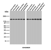 Cadherin 2 Antibody Pan-Species Brain and Heart WB. Western blot analysis of N-Cadherin / CDH2 expression across multi-species brain and heart tissue lysates using Cadherin 2 antibody clone CDH2/8862R. Lane 1: human brain lysate, Lane 2: mouse brain lysate, Lane 3: rat brain lysate, Lane 4: hamster brain lysate, Lane 5: guinea pig brain lysate, Lane 6: rabbit brain lysate, Lane 7: human heart lysate, Lane 8: mouse heart lysate, Lane 9: rat heart lysate, Lane 10: hamster heart lysate, Lane 11: guinea pig heart lysate, Lane 12: rabbit heart lysate. A band is detected at approximately 120-135 kDa, consistent with the predicted molecular weight of N-Cadherin (CDH2), with the slightly higher apparent migration reflecting known glycosylation of this transmembrane adhesion protein. The uniform band intensity and consistent migration across all species and both tissue types support the use of this Cadherin 2 antibody as a pan-species consistent detection antibody, reflecting conserved N-Cadherin expression in neural and cardiac tissues.