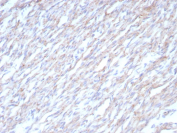 Cadherin 2 Antibody Heart Tissue IHC. Immunohistochemical analysis of N-Cadherin / CDH2 expression in formalin-fixed, paraffin-embedded human heart tissue using Cadherin 2 antibody clone CDH2/8862R. Membranous and cytoplasmic staining is observed in cardiomyocytes, with signal accentuated along cell-cell junctions consistent with localization at intercalated discs. The staining highlights elongated cardiac muscle fibers with organized architecture, while surrounding interstitial areas show minimal background. HIER: boil tissue sections in pH 9 10mM Tris with 1mM EDTA for 20 min and allow to cool before testing.