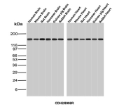 N-Cadherin Antibody Translational Brain and Heart WB. Western blot analysis of N-Cadherin / CDH2 expression across multi-species brain and heart tissue lysates using N-Cadherin antibody clone CDH2/8998R. Lane 1: human brain lysate, Lane 2: mouse brain lysate, Lane 3: rat brain lysate, Lane 4: hamster brain lysate, Lane 5: guinea pig brain lysate, Lane 6: rabbit brain lysate, Lane 7: human heart lysate, Lane 8: mouse heart lysate, Lane 9: rat heart lysate, Lane 10: hamster heart lysate, Lane 11: guinea pig heart lysate, Lane 12: rabbit heart lysate. A band is detected at approximately 120-135 kDa, consistent with the predicted molecular weight of N-Cadherin (CDH2), with the slightly higher apparent migration reflecting known glycosylation of this transmembrane adhesion protein. Detection across multiple species supports the use of this N-Cadherin antibody in translational studies bridging animal models and human tissue analysis.