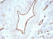 Immunohistochemistry analysis of PECAM-1 / CD31 antibody in human uterus. FFPE human uterus tissue was stained with PECAM-1 / CD31 antibody (clone C31/8831R). HRP-DAB brown chromogenic signal is observed predominantly along the endothelial lining of blood vessels within the stromal compartment, with membranous staining outlining vascular structures. Vascular endothelial cells show strong brown staining, while surrounding smooth muscle cells and stromal cells display minimal background signal. Nuclei are counterstained blue. Heat-induced epitope retrieval was performed by boiling tissue sections in 10 mM Tris with 1 mM EDTA, pH 9, for 20 minutes followed by cooling prior to antibody incubation.