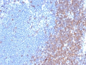CD7 Antibody Lymph Node IHC. Immunohistochemistry analysis of CD7 / T-cell antigen CD7 in human lymph node tissue shows strong HRP-DAB brown membranous staining of lymphocytes concentrated in T cell-rich paracortical regions, consistent with CD7 expression on NK cell-associated and T cell populations, with minimal background in surrounding areas. CD7 antibody clone rCD7/6972 was applied following heat-induced epitope retrieval in pH 9 Tris-EDTA buffer, supporting its use as an NK cell marker in FFPE tissue sections.