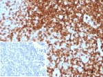 CD7 Antibody Human Tonsil IHC. Immunohistochemistry analysis of CD7 / T-cell antigen CD7 in human tonsil tissue shows strong HRP-DAB brown membranous staining of lymphoid cells within interfollicular regions, consistent with CD7 expression across T cell lineage populations, while surrounding areas remain largely negative. The inset shows absence of staining when PBS is used in place of primary antibody, confirming specificity. CD7 antibody clone CD7/8496R was applied following heat-induced epitope retrieval in pH 9 Tris-EDTA buffer, supporting its use as a T cell lineage marker in FFPE tissue sections.