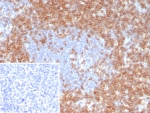 CD7 Antibody Human Tonsil IHC. Immunohistochemistry analysis of CD7 / T-cell antigen CD7 in human tonsil tissue shows strong HRP-DAB brown membranous staining of lymphoid cells within interfollicular regions with relative sparing of germinal centers, consistent with CD7-positive T lymphocyte populations relevant to leukemia and lymphoma studies, while surrounding areas remain largely negative. The inset shows absence of staining when PBS is used in place of primary antibody, confirming specificity. CD7 antibody clone CD7/8118R was applied following heat-induced epitope retrieval in pH 9 Tris-EDTA buffer, supporting its use as a leukemia and lymphoma marker in FFPE tissue sections.