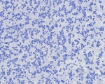 CD7 Antibody Brain Negative Control IHC. Immunohistochemistry analysis of CD7 / T-cell antigen CD7 in human brain tissue shows absence of HRP-DAB brown staining with only hematoxylin counterstain visible, consistent with lack of CD7 expression in non-lymphoid neural tissue and supporting antibody specificity. CD7 antibody clone CD7/8357R was applied at 2 ug/ml following heat-induced epitope retrieval in pH 9 Tris-EDTA buffer, serving as a negative tissue control for immune cell surface marker detection in FFPE sections.
