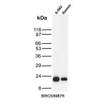 Survivin Antibody BIRC5/8987R in K-562 Leukemia and Ramos Lymphoma Cells WB. Western blot testing of human K-562 chronic myelogenous leukemia and Ramos B-cell lymphoma cell lysates with Survivin Antibody clone BIRC5/8987R shows a strong, discrete band at approximately 16-17 kDa in both samples. The observed migration is consistent with the expected molecular weight of BIRC5/survivin, supporting specific detection of the target under the tested conditions.