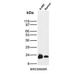 Survivin Antibody BIRC5/8936R in K-562 Leukemia and Ramos Lymphoma Cells WB. Western blot testing of human K-562 chronic myelogenous leukemia and Ramos B-cell lymphoma cell lysates with Survivin Antibody clone BIRC5/8936R shows a strong band at approximately 16-17 kDa in both samples, with greater signal intensity in K-562 cells. The observed migration is consistent with the expected molecular weight of BIRC5/survivin, supporting specific target detection under the tested conditions.