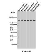 CDH2 Antibody Tissue WB. Western blot analysis of N-Cadherin / CDH2 expression across multi-species heart tissue lysates using recombinant mouse monoclonal CDH2 antibody clone rCDH2/8291. Lane 1: human heart lysate, Lane 2: mouse heart lysate, Lane 3: rat heart lysate, Lane 4: hamster heart lysate, Lane 5: guinea pig heart lysate, Lane 6: rabbit heart lysate. A band is detected at approximately 120-135 kDa, consistent with the predicted molecular weight of N-Cadherin (CDH2), with the slightly higher apparent size reflecting known glycosylation of this transmembrane adhesion protein. The consistent band pattern across species aligns with the highly conserved role of N-Cadherin in cardiac muscle cell-cell adhesion and intercalated disc structure.